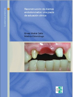 cover image of Reconstrucción de dientes endodonciados